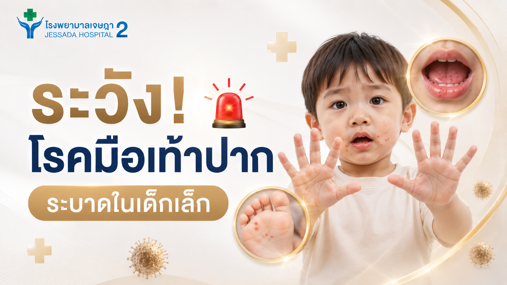 !ระวังโรคมือเท้าปากในเด็กเล็ก